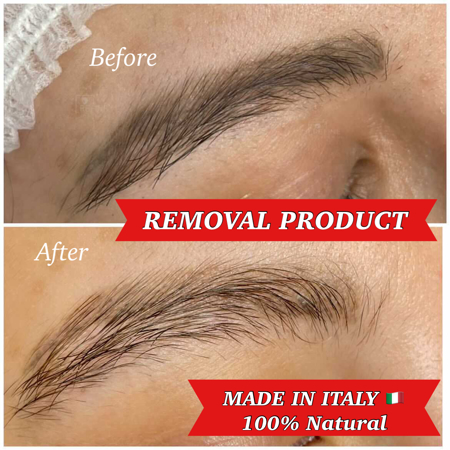 Immagine di REMOVAL 10ml